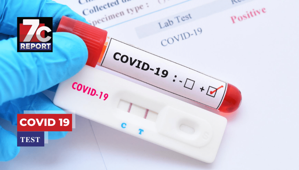 COVID-19 TEST